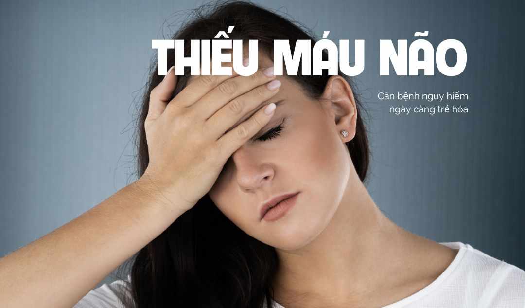 THIẾU MÁU NÃO - CĂN BỆNH NGUY HIỂM NGÀY CÀNG TRẺ HÓA